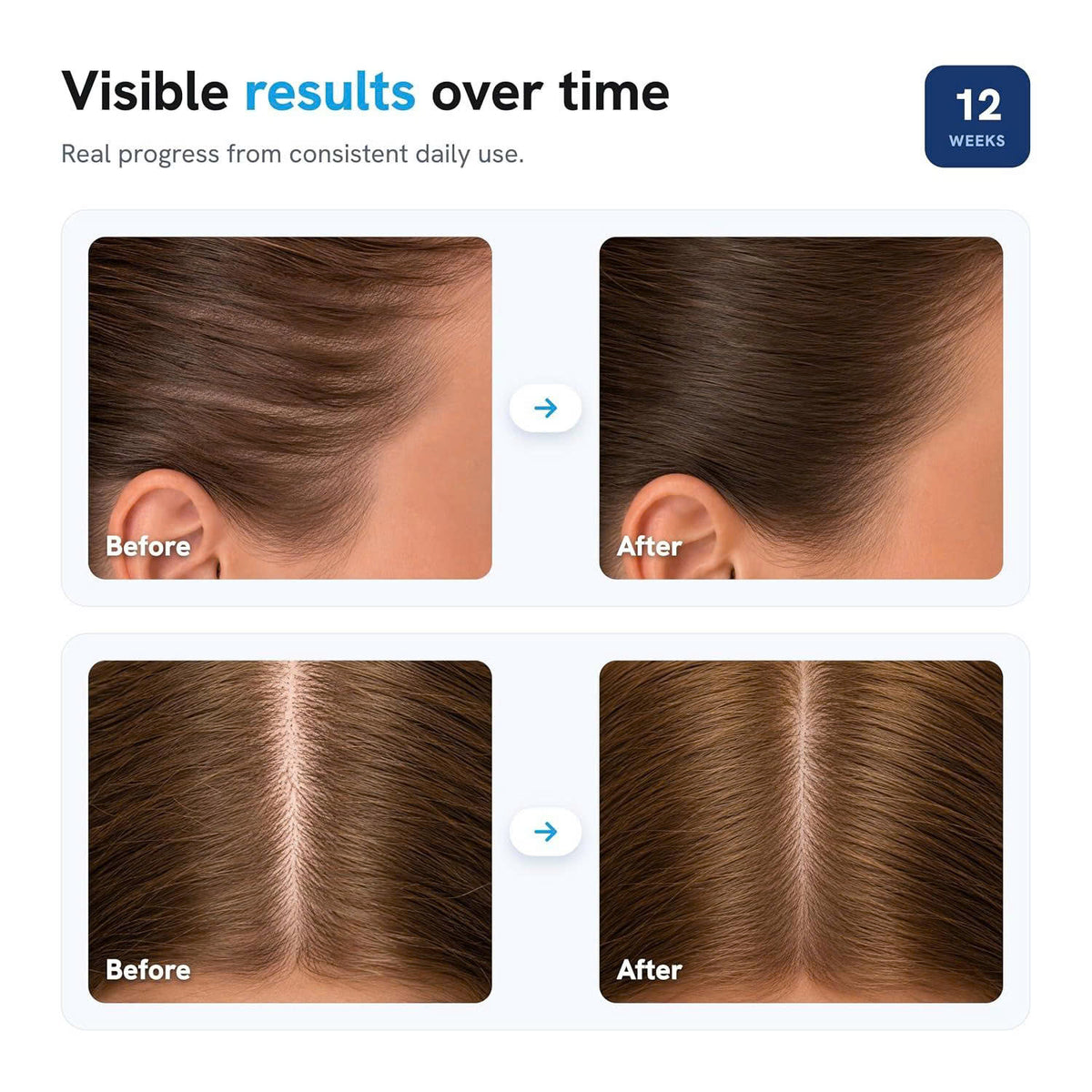 Behairwise Density Roll-On